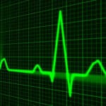 Graphique d'électrocardiogramme sur écran vert.