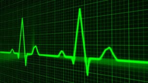 Graphique d'électrocardiogramme sur écran vert.