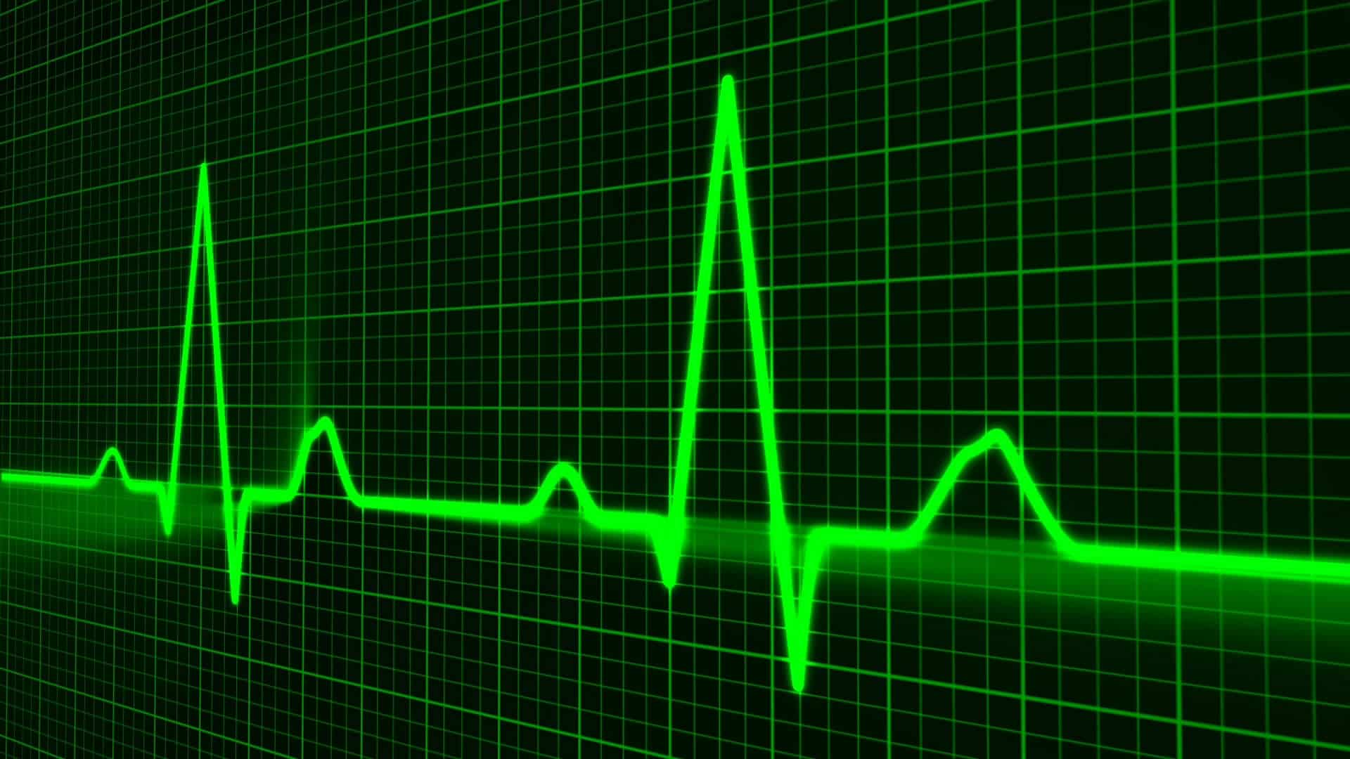 Graphique d'électrocardiogramme sur écran vert.